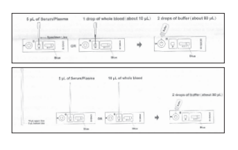 Covid-19 Igg/igm Rapid Test Cassette (Whole Blood/ Serum/ Plasma).